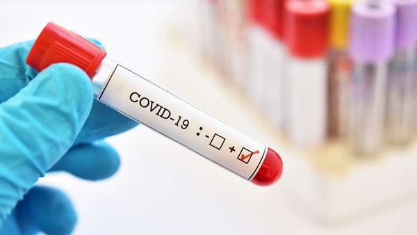 Koronavirüs Bağışıklığında Son Durum